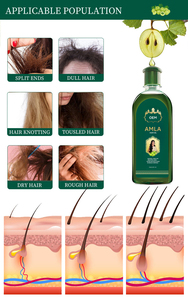 Vendita calda olio di <span class=keywords><strong>Amla</strong></span> indiano biologico prosperare prodotti per la riparazione dei <span class=keywords><strong>capelli</strong></span> olio di uva spina idratante per la cura dei <span class=keywords><strong>capelli</strong></span> - Product Image 5