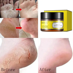 OEM 개인 라벨 안티 크랙 핸드 풋 크림 30g 수리 드라이 크랙 힐 보습 영양 진정 소프트 스킨 케어 크림 - Product Image 1