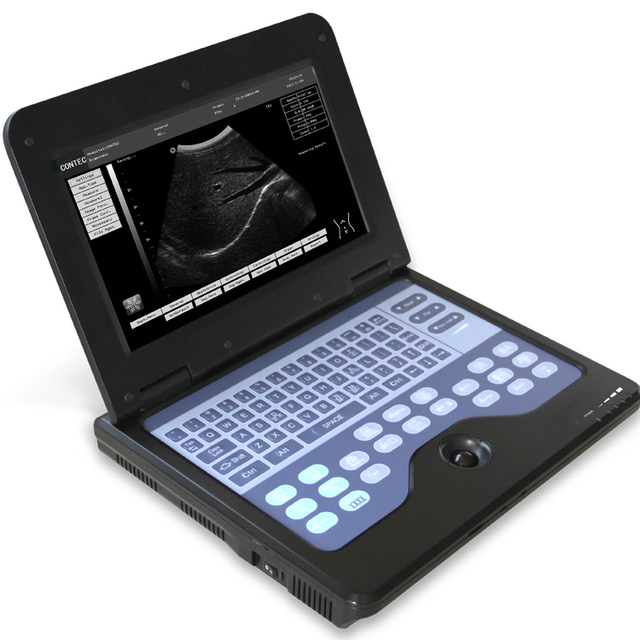 CONTEC CE Portable Certificate CMS600P2 Digital Ultrasound Scanner B-Ultrasound Diagnostic System China