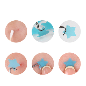 <span class=keywords><strong>Cerotti</strong></span> Trasparenti PE a Forma di Macaron, Stella e Cuore per Coprire Acne, Impermeabili, Delicati sulla Pelle, Invisibili per il Trucco, Adesivi per Coprire Brufoli, Imperfezioni e <span class=keywords><strong>Nei</strong></span> sul Viso - Product Image 4