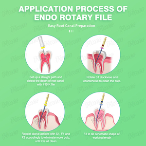 Hộp <span class=keywords><strong>endo</strong></span> tập tin nha khoa sử dụng tay khoan nha khoa cho các tập tin kênh gốc Nha Khoa Điều Trị kênh gốc nội nha - Product Image 4