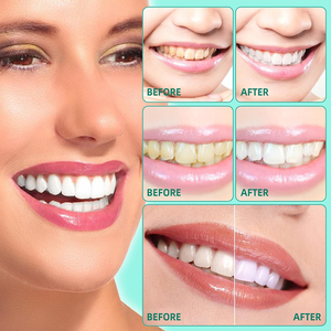 Private Label naturale bocca lavata orale cura tirando <span class=keywords><strong>olio</strong></span> <span class=keywords><strong>di</strong></span> <span class=keywords><strong>cocco</strong></span> <span class=keywords><strong>olio</strong></span> <span class=keywords><strong>di</strong></span> menta piperita <span class=keywords><strong>per</strong></span> la salute orale <span class=keywords><strong>denti</strong></span> sbiancamento collutorio - Product Image 4