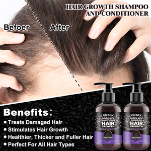 OEM de lujo <span class=keywords><strong>mejor</strong></span> anti <span class=keywords><strong>caída</strong></span> <span class=keywords><strong>del</strong></span> <span class=keywords><strong>cabello</strong></span> champú Biotin queratina crecimiento <span class=keywords><strong>del</strong></span> <span class=keywords><strong>cabello</strong></span> champú y acondicionador <span class=keywords><strong>para</strong></span> <span class=keywords><strong>la</strong></span> <span class=keywords><strong>caída</strong></span> <span class=keywords><strong>del</strong></span> <span class=keywords><strong>cabello</strong></span> - Product Image 3