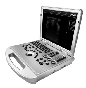 Ecógrafo Doppler Color Portátil de Alto Rendimiento Dawei DW-L3, Diseño Tipo Laptop para Diagnóstico en Hospitales Primarios - Product Image 6