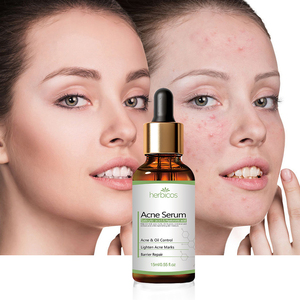 Sérum Anti-Acné à <span class=keywords><strong>2</strong></span>% d'<span class=keywords><strong>Acide</strong></span> <span class=keywords><strong>Salicylique</strong></span> Marque Blanche – Contrôle du Sébum, Réduit les Pores, Répare les Cicatrices d'Acné pour Peaux Grasses, Sensibles et à Tendance Acnéique – OEM - Product Image 3