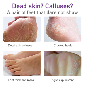 <span class=keywords><strong>Masque</strong></span> exfoliant pour les pieds à la lavande, marque privée OEM ODM, éliminateur de callosités, élimination des peaux mortes, chaussettes hydratantes pour le soin des pieds - Product Image 3