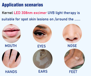 Lámpara UVB de 308nm de Grado Médico, Portátil, para Uso Doméstico, Lámpara de Fototerapia Excimer LED UVB de 308nm para el Tratamiento de Vitiligo, Psoriasis y Eccema - Product Image 6