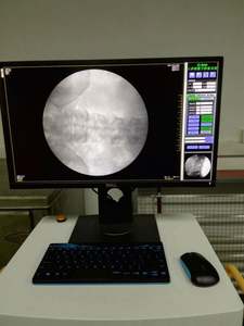 Tıbbi dijital radyografi <span class=keywords><strong>c</strong></span>-kol <span class=keywords><strong>x</strong></span>-<span class=keywords><strong>ray</strong></span> makineleri sistemleri cerrahi 3.5kw <span class=keywords><strong>c</strong></span>-kol <span class=keywords><strong>X</strong></span> ışını makinesi fiyat - Product Image 6