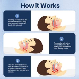 Dispositivos Anti Ronquidos, Protector <span class=keywords><strong>Bucal</strong></span> Ajustable y Reutilizable, Solución Contra los Ronquidos - Product Image 6