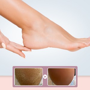 Crème pour les pieds SOUTH MOON <span class=keywords><strong>Chili</strong></span> Wood - Des ingrédients doux nourrissent la peau des pieds, apportant hydratation, humidité et une texture lisse. - Product Image 3