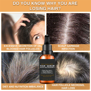 Croissance des cheveux Huile essentielle Rapide Efficace Bio gingembre soin des cheveux pour cuir chevelu nourrissant anti perte sérum réparateur pour hommes et femmes - Product Image 4