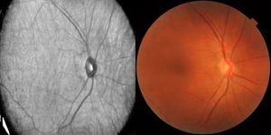 Quang học kết hợp chụp Cắt Lớp velite c808b Oct chụp động mạch Thiết bị đo thị lực thông minh dụng cụ Nhãn KhoA - Product Image 6