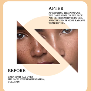 Marque privée <span class=keywords><strong>Acide</strong></span> <span class=keywords><strong>glycolique</strong></span> Tonique ordinaire Nettoyant naturel Hydratant Visage Sérum d'hydratation Tonique pour le visage - Product Image 4
