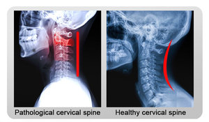 Trabajo Estudio Cuello Soporte Brace Dispositivo de tracción <span class=keywords><strong>Collar</strong></span> cervical para aliviar el dolor Presión en la columna - Product Image 5