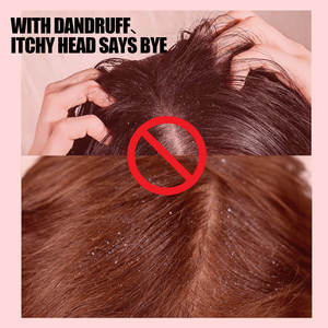 Vente en gros South Moon 50g Shampooing cheveux Shampooing antipelliculaire et au soufre pour démangeaisons - Product Image 4