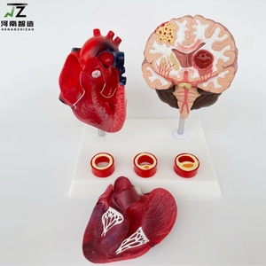 Maniquí de Demostración para la Enseñanza de Enfermedades Cardiovasculares y Cerebrovasculares Humanas, con Edad y Tamaño Real, en PVC Avanzado - Product Image 2