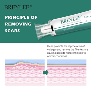 Formule de gel professionnelle | Aide à améliorer l'apparence des cicatrices et des taches sombres | pour les soins du visage et du corps | OEM/Vente en gros disponible - Product Image 3