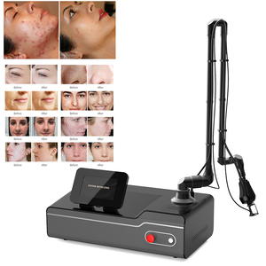 Latest High Quality Electric CO2 Fractional Laser Machine Accessories for Home Use Face Hand Rejuvenation Targeting Custom Made - Product Image 1