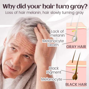 Logo personnalisé Jaysuing Anti White Grey Hair Treatment Spray pour la <span class=keywords><strong>restauration</strong></span> des cheveux Spray pour la repousse des cheveux - Product Image 3