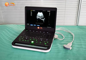 SUN-800C Woman Pregnancy Ultrasound Scanner <strong>Ecography</strong> Laptop Digital USG Diagnostic PW BW Ultrasound Machine - Product Image 2
