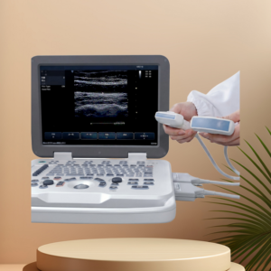 Escáner Veterinario SONOIMAGE D20 <span class=keywords><strong>Prestige</strong></span> con Estructura Adaptada para Viajes, Ofrece Imágenes Brillantes para una Clasificación Acelerada de Animales de Granja - Product Image 1