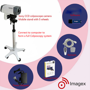 <span class=keywords><strong>Vaginoscope</strong></span> électronique numérique Colposcope vidéo pour examen gynécologique - Product Image 1