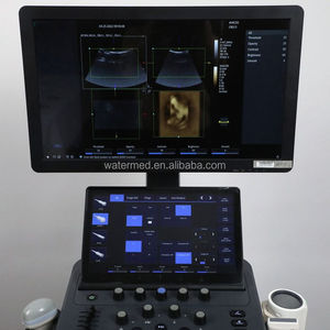 Zoncare Animal humano 3D/4D Trolley Medical Digital Color Doppler Sistema de ultrasonido - Product Image 5