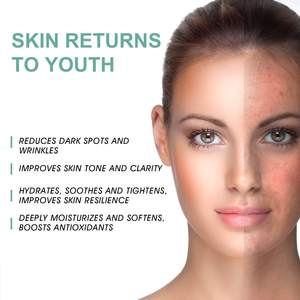 Siero di retinolo organico antirughe per il viso Mzel all'ingrosso 2.5% con vitamina <span class=keywords><strong>A</strong></span>, E, acido ialuronico - Product Image 5