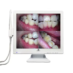 factory direct supply A3S-X HD dental intraoral camera with 17 Inch color LCD monitor get immediate HD dental images