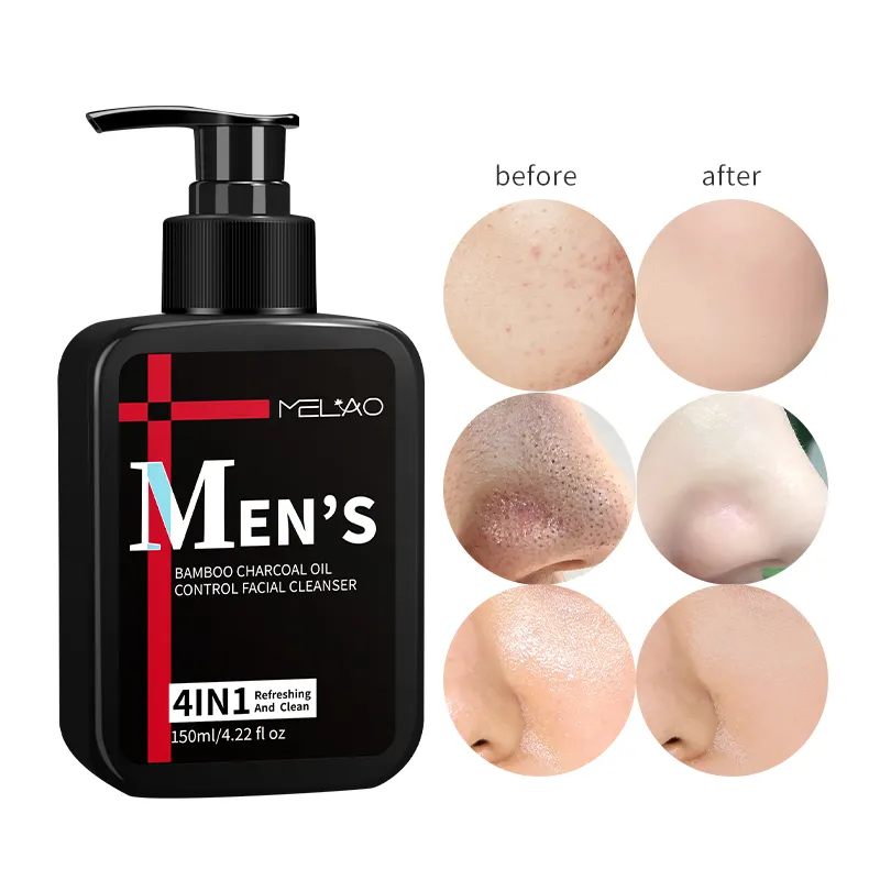 पुरुषों की त्वचा देखभाल लोगो को गहरी साफ मॉइस्चराइजिंग तेल नियंत्रण मुँहासे को अनुकूलित कर सकती है 1 पुरुषों के चेहरे की सफाई