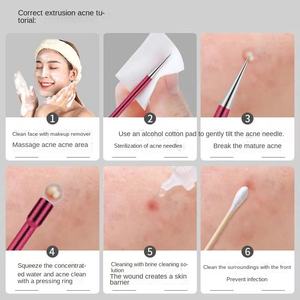 Ekstraktor jerawat komedo untuk salon kecantikan alat perawatan jerawat halus lintas batas setelan klip sel tertutup hitam untuk jerawat wajah - Product Image 4