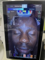 Analyseur de peau IA multi-spectre, appareil d'analyse faciale WiFi US avec écran tactile pour salon de beauté, acné, pigmentation, usage domestique