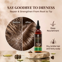 Huile de ricin 100% naturelle et biologique pour le soin du cuir chevelu et des dreadlocks, marque privée, CN