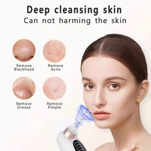 Limpiador Facial Eléctrico Portátil USB-C <span class=keywords><strong>de</strong></span> Succión <span class=keywords><strong>de</strong></span> Puntos Negros y Acné con Microburbujas, el Más Vendido - Product Image 2