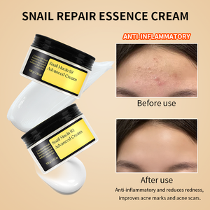 Crema con 92% de Mucina de Caracol, Madecassoside, Pantenol, Antiarrugas, Blanqueadora, Calmante, Repara el Enrojecimiento, Mejora las Marcas del Acné, para Todo Tipo de Piel - Product Image 5