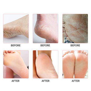 Vui vẻ kết cấu thực vật chiết xuất chân nhẹ nhàng làm mềm tẩy tế bào chết làm mới Pha Lê Thạch Chân Tắm muối Bộ - Product Image 2