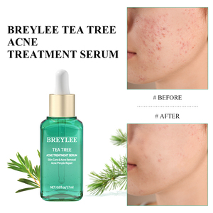 BREYLEE เซรั่มบำรุงผิวหน้าด้วยทีทรีออยล์ ลดสิว รักษาสิว ให้ผลลัพธ์ที่ดีที่สุด - Product Image 2
