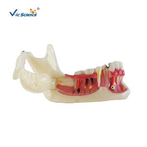 Modelo Dental Anatómico de Dientes Posteriores Inferiores Derechos en Resina y PVC para Educación en Ciencias Médicas en Escuelas y Hospitales - Product Image 1