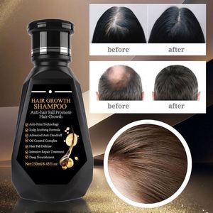 Shampooing <span class=keywords><strong>Disaar</strong></span> à l'extrait de gingembre pour la croissance des cheveux, biotine, conditionneur nourrissant aux herbes pressées à froid, fortifiant capillaire, marque privée - Product Image 1