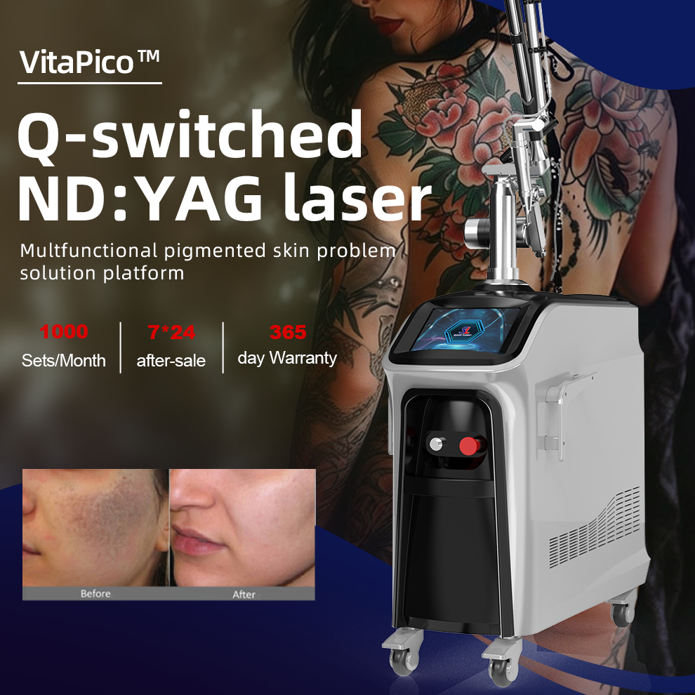 Q-Switch Nd Yag - Lampe unique, double tige