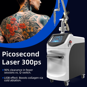 Máquina de Remoção de Tatuagens a Laser Picosegundo 300ps 6 em 1 com ND YAG 755nm para Remoção de Pigmentos de Tatuagem e Rejuvenescimento da Pele - Product Image 1
