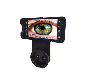 Equipo oftálmico Aparato de Oftalmología Imágenes Lámpara de hendidura <span class=keywords><strong>digital</strong></span> Sistema de imágenes AIO para diagnóstico de oftalmólogo - Product Image 4