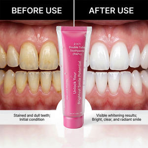 Dentifricio Sbiancante con Logo Personalizzato, al Fluoro, per Alito Fresco, PAP HP, Formato da Viaggio 100g - Product Image 1