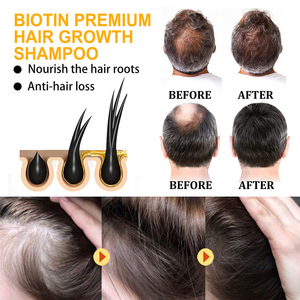 All-British Cross-Border Biotin Shampooing et gel après-shampooing pour <span class=keywords><strong>cheveux</strong></span> longs <span class=keywords><strong>Anti</strong></span>-pelliculaire <span class=keywords><strong>Anti</strong></span>-<span class=keywords><strong>chute</strong></span> des <span class=keywords><strong>cheveux</strong></span> Contrôle de l'huile - Product Image 4