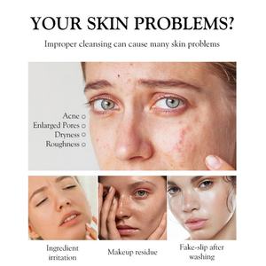 Mousse Nettoyante Visage 150ml Formule Douce Naturelle Soin Peau Contrôle Sébum Resserre Pores Vente en Gros - Product Image 3