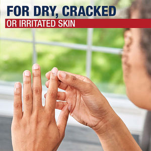 Crema Hidratante Terapéutica Avanzada OEM/ODM, Resistente al Agua, Vegana, con Ceramida para el Acné y Todo Tipo de Piel, Repara y Curar la Elasticidad - Product Image 6