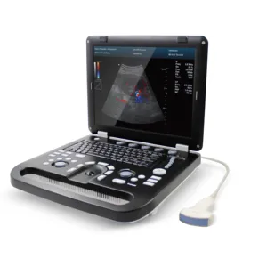 Contec cms1700c sistema de diagnóstico ultrassônico, doppler de cor usg