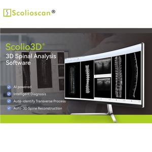 Estación de trabajo de evaluación de escoliosis Software 3D de algoritmo AI - Product Image 3