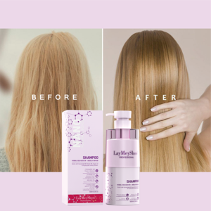 <span class=keywords><strong>Shampoo</strong></span> OEM Superiore all'Acido Ialuronico, Rinfrescante, Illuminante, Nutriente e Rinfrescante per la Cura del Cuoio Capelluto, Adatto a Tutti i Tipi di Capelli - Product Image 4