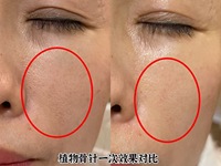 Crème Visage Anti-Rides Liftante et Raffermissante à l'Extrait d'Algues et Spicules pour Salons de Beauté